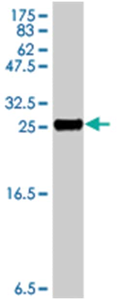 EMP3, Mouse, Polyclonal Antibody, Abnova 50&mu;L; Unlabeled:Antibodies,