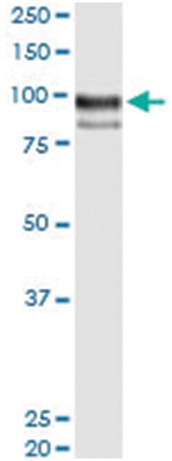 ENG, Human, IP-WB Antibody Pair (PW1), Abnova&trade;