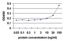 Abnova Corporation ENO1, Human, Matched Antibody Pair (AP52), Abnova™