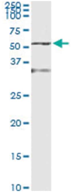 anti-ENO1, Human, IP-WB Antibody Pair, Abnova&trade;