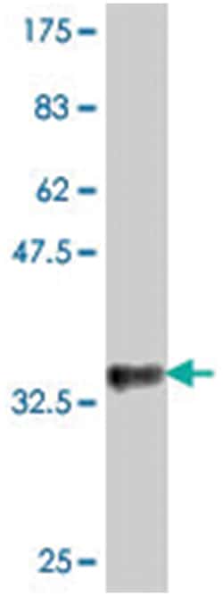 EPB41L1, Mouse, Polyclonal Antibody, Abnova 50&mu;L; Unlabeled:Antibodies,