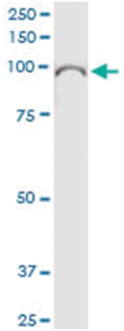 anti-EPB41L1, Human, IP-WB Antibody Pair, Abnova&trade;