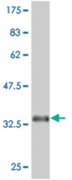 EPHA5, Mouse, Clone: 6F4, Abnova 100&mu;g; Unlabeled:Antibodies, Monoclonal
