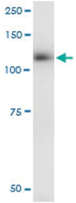 anti-EPHB3, Human, IP-WB Antibody Pair, Abnova&trade;