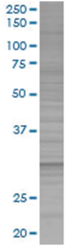 EPIM 293T Cell Overexpression Lysate (Denatured), Abnova 100 &mu;L | Buy Online | Abnova | Fisher Scientific