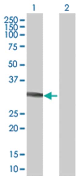 EPIM 293T Cell Overexpression Lysate (Denatured), Abnova 100 &mu;L | Buy Online | Abnova | Fisher Scientific