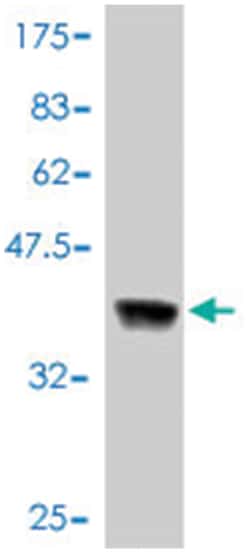 v-erb-b2 erythroblastic leukemia viral oncogene homolog 2, neuro/glioblastoma