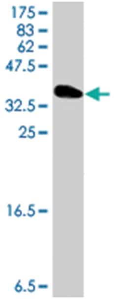 EREG, Mouse, Polyclonal Antibody, Abnova 50&mu;L; Unlabeled:Antibodies,