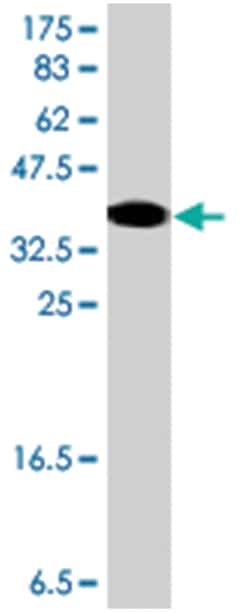 ERCC6, Mouse, Polyclonal Antibody, Abnova 50&mu;L; Unlabeled:Antibodies,