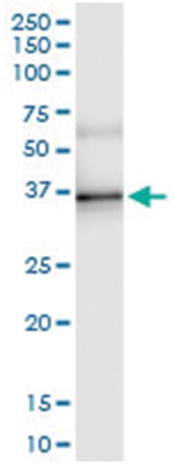 anti-ESD, Human, IP-WB Antibody Pair, Abnova™