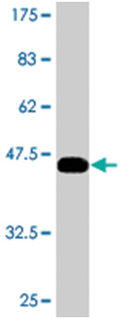 ETV6, Mouse, Polyclonal Antibody, Abnova 50&mu;L; Unlabeled:Antibodies,