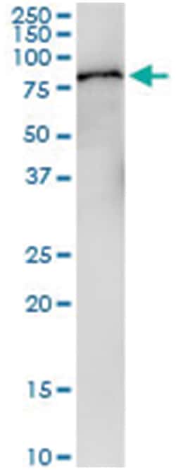 anti-F2, Human, IP-WB Antibody Pair, Abnova&trade;