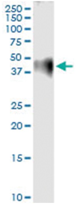 anti-F2R, Human, IP-WB Antibody Pair, Abnova 1 Set:Antibodies, Monoclonal/Polyclonal