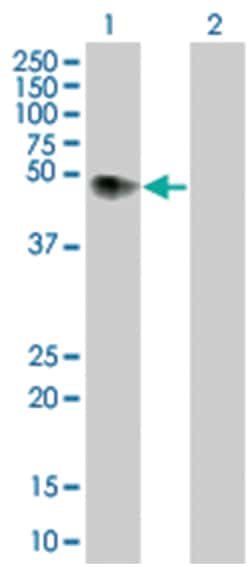 F2R 293T Cell Overexpression Lysate (Denatured), Abnova 100&mu;L:Protein
