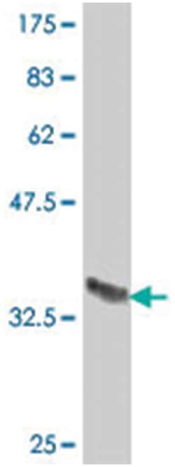 F7 (A01), Mouse anti-Human, Polyclonal Antibody, Abnova 50&mu;L; Unlabeled:Antibodies,