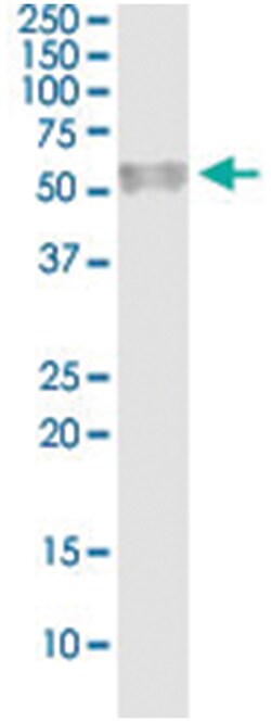 anti-F7, Human, IP-WB Antibody Pair, Abnova&trade;