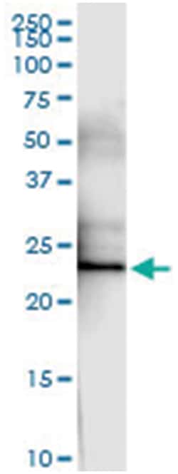anti-F8, Human, IP-WB Antibody Pair, Abnova&trade;