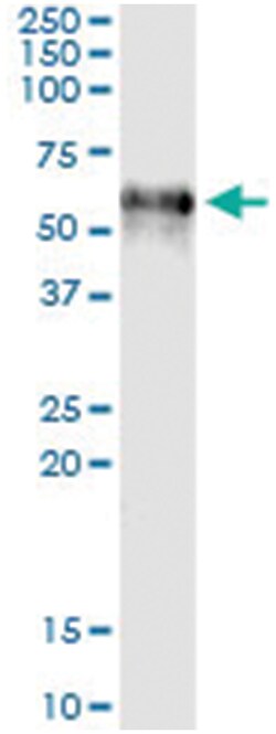 anti-F9, Human, IP-WB Antibody Pair, Abnova&trade;