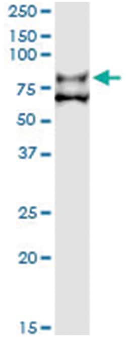 F11, Human, IP-WB Antibody Pair (PW1), Abnova 1 Set:Antibodies, Monoclonal/Polyclonal