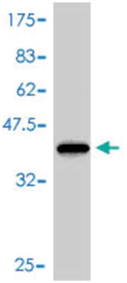 FABP1, Mouse, Polyclonal Antibody, Abnova 50&mu;L; Unlabeled:Antibodies,
