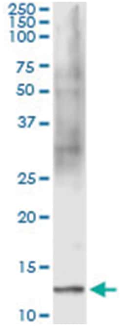 FABP1, Human, IP-WB Antibody Pair (PW1), Abnova&trade;