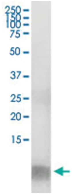 FABP1, Human, IP-WB Antibody Pair (PW2), Abnova 1 Set:Antibodies, Monoclonal/Polyclonal