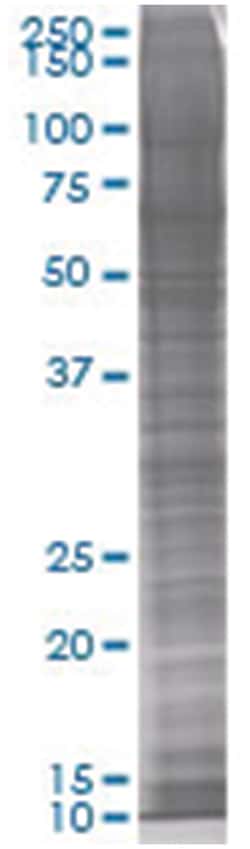 100UL FANCA 293T Cell Transient Overexpression Lys