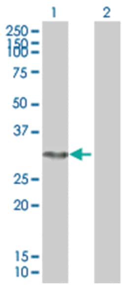 FANCA 293T Cell Overexpression Lysate (Denatured), Abnova 100 &mu;L | Buy Online | Abnova | Fisher Scientific