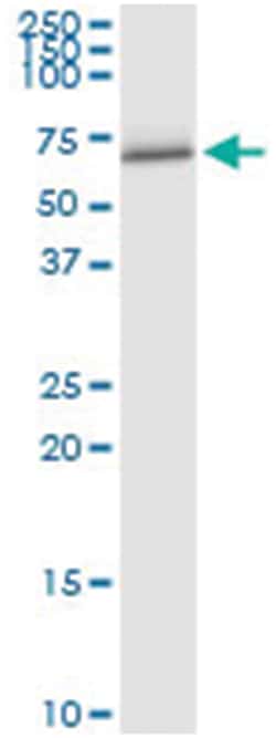 anti-FANCC, Human, IP-WB Antibody Pair, Abnova 1 Set:Antibodies, Monoclonal/Polyclonal