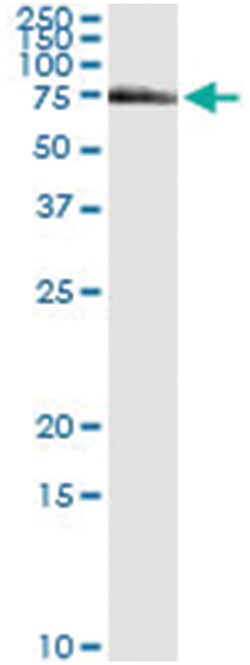 FANCG, Human, IP-WB Antibody Pair (PW1), Abnova&trade;
