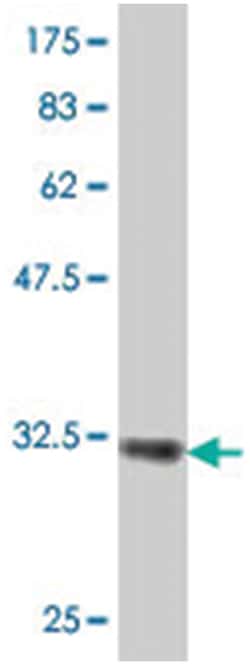 MS4A2, Mouse, Polyclonal Antibody, Abnova 50 &mu;L | Buy Online | Abnova | Fisher Scientific
