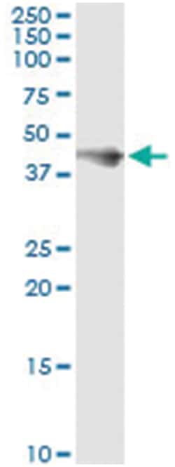 FCER2, Human, IP-WB Antibody Pair (PW1), Abnova™