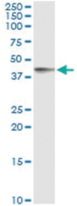 FCER2, Human, IP-WB Antibody Pair (PW2), Abnova&trade;