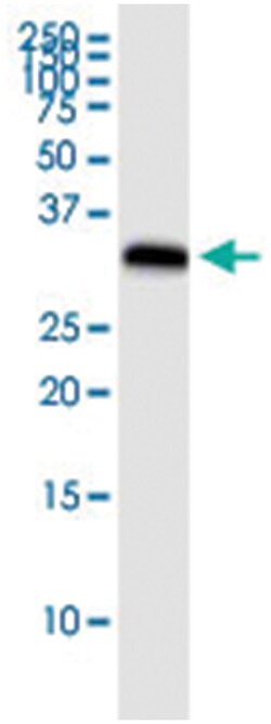 anti-FCN1, Human, IP-WB Antibody Pair, Abnova 1 Set:Antibodies, Monoclonal/Polyclonal