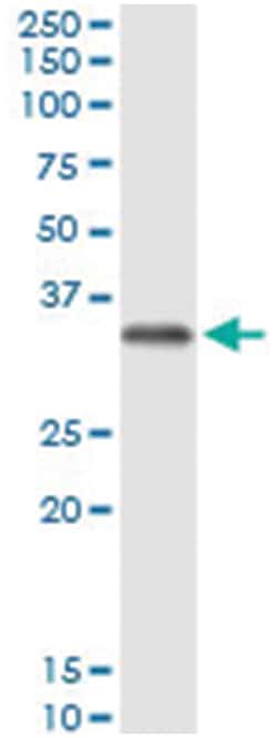 anti-FCN2, Human, IP-WB Antibody Pair, Abnova&trade;