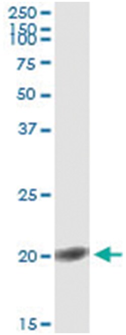 FGF1, Human, IP-WB Antibody Pair (PW2), Abnova™