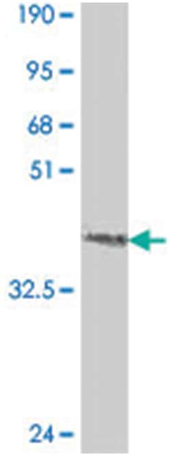 FGF9, Mouse, Polyclonal Antibody, Abnova 50&mu;L; Unlabeled:Antibodies,