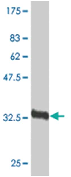 FGFR1 (M09J), Mouse anti-Human, Clone: 1B12, Abnova™