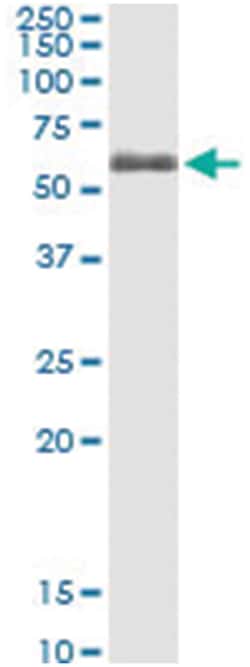 anti-FGR, Human, IP-WB Antibody Pair, Abnova&trade;