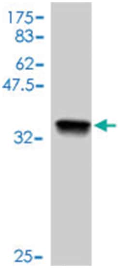 FHIT, Mouse, Polyclonal Antibody, Abnova 50 &mu;L | Buy Online | Abnova | Fisher Scientific
