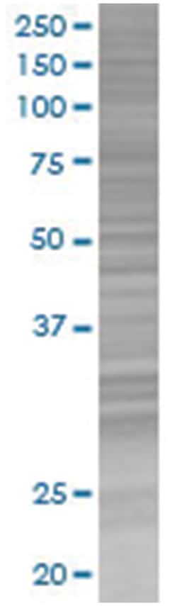 FHL1 293T Cell Overexpression Lysate (Denatured), Abnova 100 &mu;L | Buy Online | Abnova | Fisher Scientific