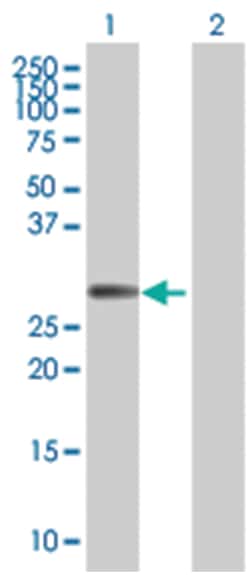 FHL1 293T Cell Overexpression Lysate (Denatured), Abnova 100 &mu;L | Buy Online | Abnova | Fisher Scientific
