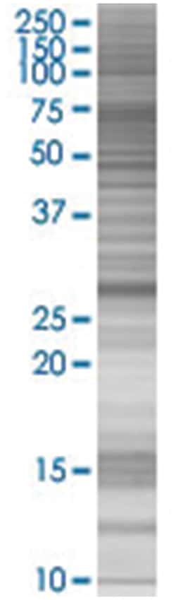 FHL2 293T Cell Overexpression Lysate (Denatured), Abnova 100 &mu;L | Buy Online | Abnova | Fisher Scientific