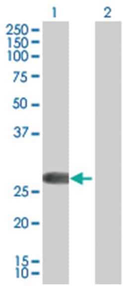 100UL FHL2 293T Cell Transient Overexpression Lysa