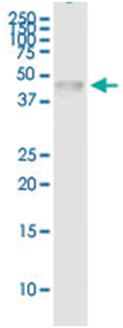 anti-FIGF, Human, IP-WB Antibody Pair, Abnova&trade;