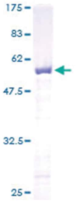 Abnova FKBP3 Recombinant Protein 10 &mu;g | Buy Online | Abnova&trade; | Fisher Scientific