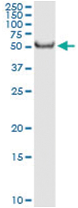 FKBP4, Human, IP-WB Antibody Pair (PW1), Abnova&trade;