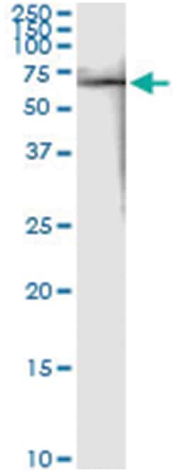 FKBP4, Human, IP-WB Antibody Pair (PW2), Abnova™