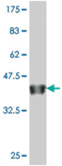 FOXG1B, Mouse, Polyclonal Antibody, Abnova 50&mu;L; Unlabeled:Antibodies,