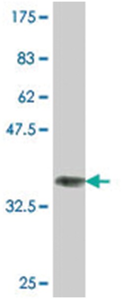 forkhead box C1, Mouse, Clone: 4D11, Abnova 100&mu;g; Unlabeled:Antibodies,